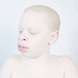 Snow White #08 : Albinos; like photographic material; are light sensitive. Light leaves an irreversible imprint on their body. This whiteness that makes them stand out; when captured in an image; almost makes them dissolve; consumed by the light. Their eyes can hardly bear it. They are a metaphor; a symbol for stereotypes; they magnify the erroneous idea of human weaknesses and physical fragility but also that of invincible beauty. Touched by their breath-taking vulnerability; in this series; I try to create a powerful impression of this fragile white beauty.