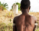 Life after Kony : Young girl still living with a bullet in her body, after crossfires between LRA and official troops.