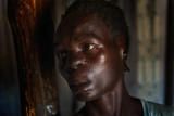 Life after Kony : Margaret heavily injured waits for compensation.