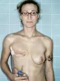 Self-Portrait, Post-Mastectomy : Aftermath series