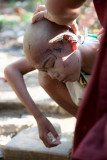 Choices They Make; Bleeding Young Monk : The hazards of being shaved quickly when becoming a monk.